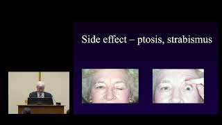 Botulinum Toxin for Blepharospasm - David Buckley, MD