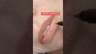 สักปากแก้คล้ำ #filler #lipstatoo #ฝังสีปาก #lips #beauty #สักปาก #makeup