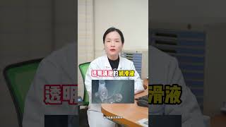 dou是知识 医学科普 冷知识 科普一下 女性科普