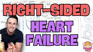 Right Sided Heart Failure