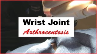 Wrist Joint Arthrocentesis Procedure