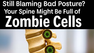 Can Killing Off Aging Cells Fix Your Spine? The Science of Senolytic Back Repair