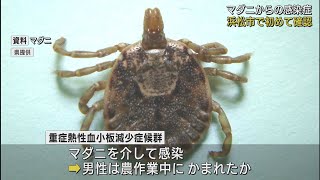 マダニから感染…　浜松市で重症熱性血小板減少症候群の患者を確認