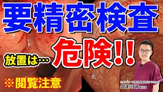 放置しておくと危険!?  要精密検査って症状が何もなければ大丈夫？ 教えて久津川先生 No137