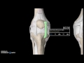 Knee Anatomy Tutorial (Ligaments)