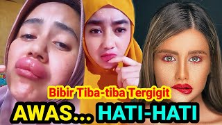 Bibir Tiba-tiba Tergigit, Awas..! Ini Artinya yang Harus Kamu Tahu