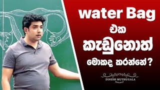 ගැබිනි අම්මලගේ Water Bag එක කැඩෙනවා කියන්නෙ මොකක්ද ? | පෙකණිය දරුවගෙ බෙල්ලෙ එතෙන්නෙ මොකක් උනාමද?