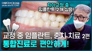 교정 중에 통합진료까지 한번에! 2탄