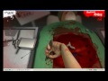 ms1000 lets play surgeon simulator part 2 i lost the heart agian