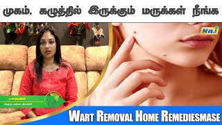 முகம், கழுத்தில் இருக்கும் மருக்கள் நீங்க.! இயற்கை வைத்தியம்.! | Remedy For Warts | Raj Television