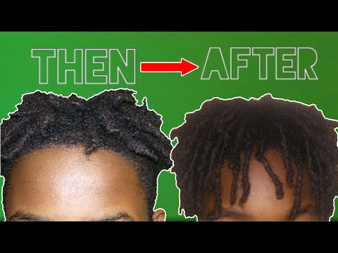 High Top Dreads | 5 Tips To Make Your Dreadlocks Grow Faster!! High Top Dreads | 5 Tips To Make Your Dreadlocks Grow Faster!!