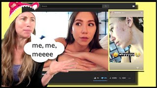 Kalel, what happened to you?? No Longer Vegan, weight gain, acne...