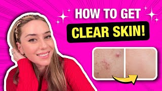 Best Clear Skin Tips from a Dermatologist That Actually Work! | Dr. Shereene Idriss