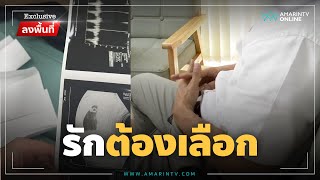 เปิดใจพ่อพลทหาร คว่ำงานแต่งรักษาพ่อป่วยมะเร็ง | Exclusive ลงพื้นที่