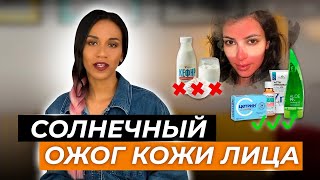 Солнечный ожог кожи лица: как быть и что делать? Алгоритм действий при ожоге кожи лица