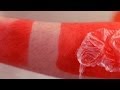 WORLD'S WORST SUNBURN! WORLD'S WORST SUNBURN!