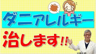 ハウスダスト・ダニのアレルギーを治す舌下免疫療法とは？大久保公裕先生がやさしく解説