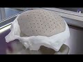 3d printing decentral clean room production for medical technology – interview with kumovis gmbh