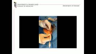 14.34-14.51: From ECMO to LVAD: A Bridge to Bridge Concept, Zachary N. Kon, MD