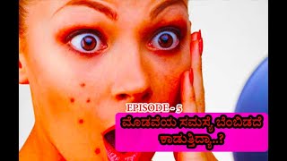 ಮೊಡವೆಯ ಸಮಸ್ಯೆ ಬೆಂಬಿಡದೆ ಕಾಡುತ್ತಿದ್ಯಾ..? home remedies for pimples..