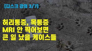 허리통증, 목통증 MRI 안 찍어보면 큰 일 났을 케이스들 [강의 3/7]