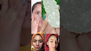 fitkari ke fayde face ke liye ! jhaaeyo ko kaise hataye ! remove pigmentation #shorts #ytshorts