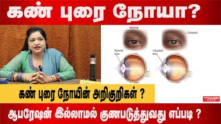 கண் புரை நோயின் அறிகுறிகள் | cataract symptoms | cataract home remedies in tamil | cataract drops