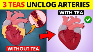 Only 3 Teas That Unclog Arteries, Lower High Blood Pressure & Prevent Heart Attack