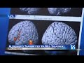 Health News 18: Alzheimer's transmitted via med treatment