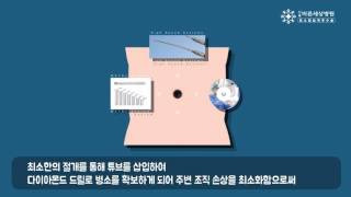 서울바른세상병원 I 최소침습척추수술