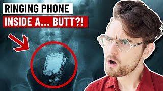 Most Shocking Things Found Inside A Human Body!