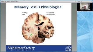 Webinar I Helping with memory loss