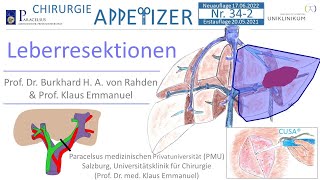 Leberresektionen CHIRURGIE APPetizer Nr  34-2 NEUAUFLAGE