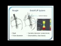 Emerging Technology Session: ET011 INTRAOPERATIVE DISTENSIBILITY AS MEASURED