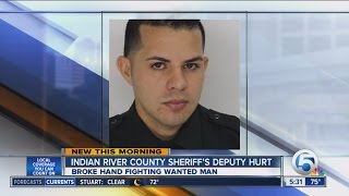 Indian River Co. deputy's hand broken during altercation with suspect