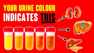 Your Urine Color Indicates This About Your Health