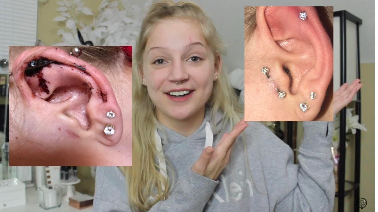 Piercings Gone Wrong