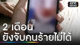 สาวโรงงานถูกสาดน้ำกรด 2 เดือนยังจับคนร้ายไม่ได้ | ข่าวเย็นช่องวัน | สำนักข่าววันนิวส์