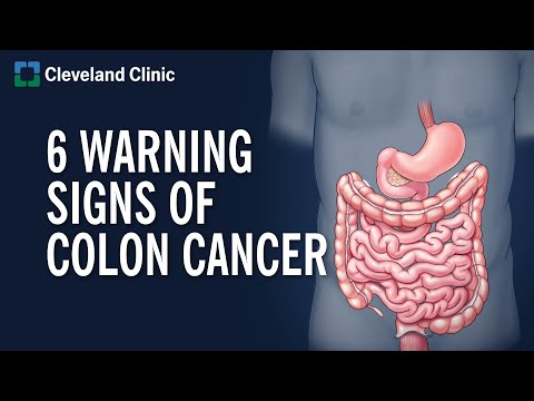 How do you know if your colon is clean?