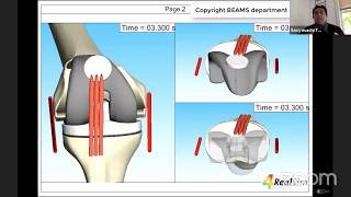 Robotic Joint Arthroplasty