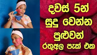 දවස් 5න් සුදු වෙන්න පුළුවන් රතු අල පැක් එක | Skin Whitening Beetroot Face Pack in Sinhala