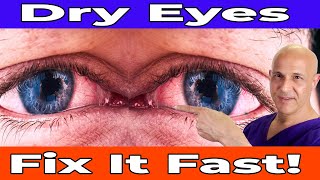 The Real Reason Your Eyes Are Dry – And How to Fix It!  Dr. Mandell