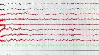 Zoom sur l'épilepsie