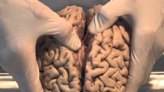Introduction: Neuroanatomy  Lab - Brain Dissections