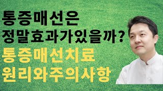 [어깨동무한의원]통증매선은정말효과가있을까? 통증매선치료원리와주의사항_김성민원장