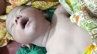 How to Resuscitate Newborn baby How to do Neonatal Resuscitation and CPR of Premature baby