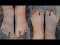 ଗର୍ଭ ସମୟରେ ପାଦ ଫୁଲାର କାରଣ ଓ ନିରାକରଣ odia health tips causes and remedies for swollen feets varkha