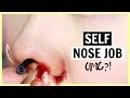 Self Nose Job?! Rhinoplasty Stealth First Impression Self Nose Job?! Rhinoplasty Stealth First Impression
