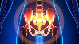 Wise Anderson Protocol - A Headache in the Pelvis