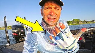 SKIN Cancer SUCKS ~ DISCOVERED new SPECIES of FISH for my LAKE!